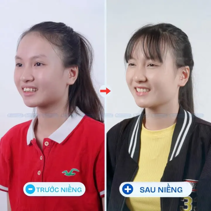 Thay đổi góc nghiêng chỉ cần một quyết định ở mình thôi! – ảnh 2