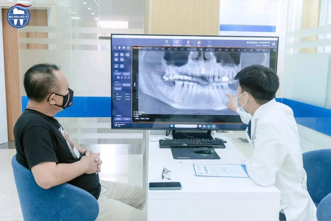 Tổng quát răng Miễn phí cho dân Cẩm Phả – ảnh 2